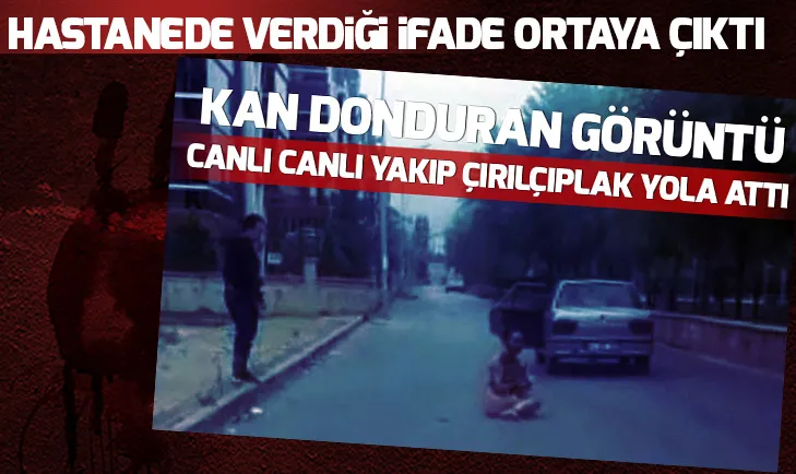 Diri diri yakılmıştı! İfadesi ortaya çıktı