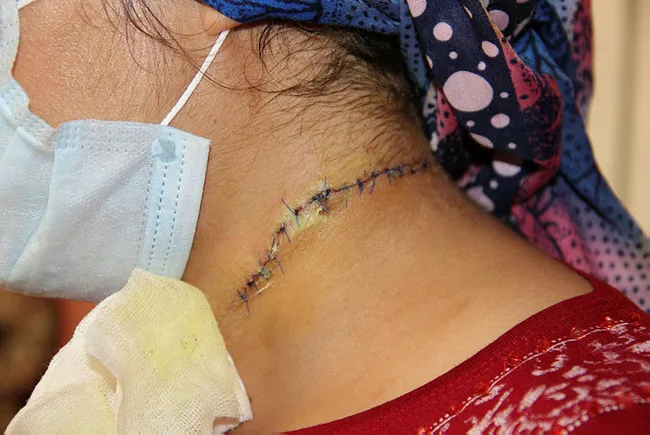 Manisa'da eşi tarafından boğazı kesilen Esra Oymak: Hayatım karardı - 4