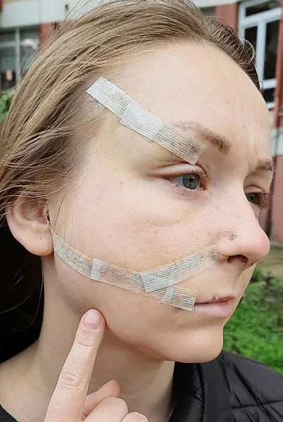 Boşanmak istediği için kocasının yüzünü falçatayla parçalandığı Ukraynalı Hanna yeni bir hayat kurdu - 2