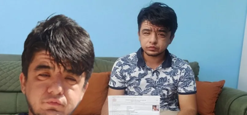 Gerçekte 20 yaşında, 40 yaşında gibi gösteriyor! Nedeni herkesi şaşırtıyor: İzah edemiyorum
