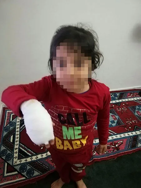 Şanlıurfa'da sokakta dehşet! 6 çocuk kanlar içerisinde kaldı, 3'ünün durumu ağır - 2
