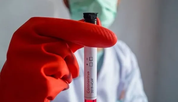 Son dakika: Covid-19’un Brezilya mutasyonu Çekya’ya sıçradı