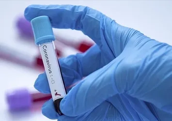 Dünya Sağlık Örgütü'nden koronavirüs uyarısı! Kovid-19'un BA.2.86 varyantı 11 ülkede tespit edildi