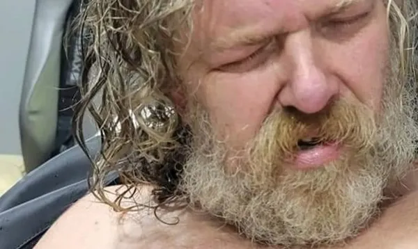 ABD’de vahşet! Komadan 2 yıl sonra uyandı, ilk sözleri şoke etti