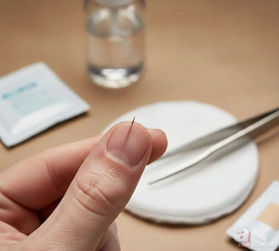 Küçük ama riskli! Kıymık çıkarırken dikkat etmeniz gerekenler 4