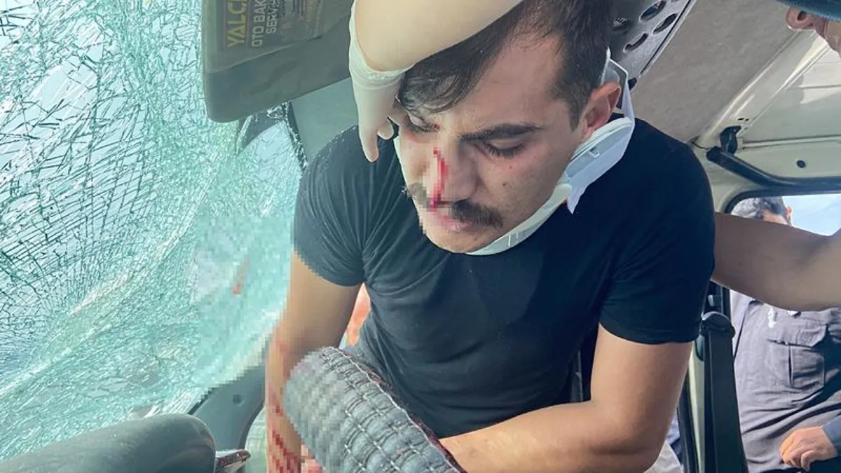 Aksaray'da kaza sonrası ilginç anlar! Canını unuttu: Yüzünün derdine düştü: 'Yüzüm çok mu kötü?'