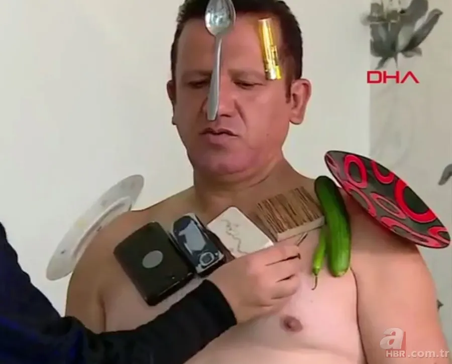 Görenler hayrete düşüyor! Ağrıları dahil her şeyi çekiyor 2