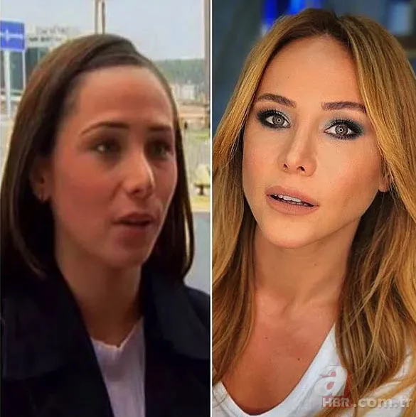 Seda Sayan'ın son hali şaşkına çevirdi! Estetik sonrası... 19