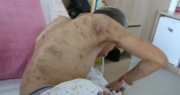 Ankara’da facia! 12 yaşındaki çocuk 10 köpeğin saldırısına uğradı