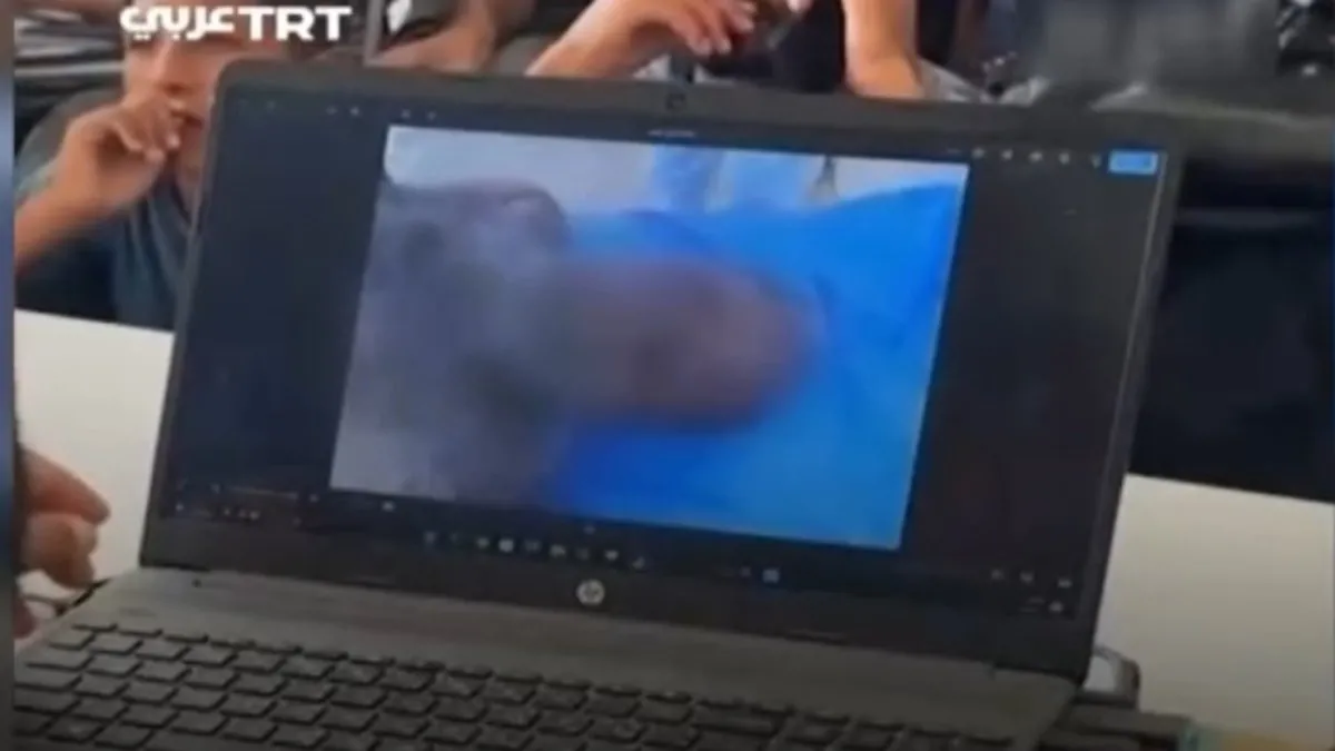 İsrail vahşetini geldiği son nokta: Terör devletinin Organ hırsızlığı belgelendi! A Haber'de dikkat çeken yorum: İsrail organ mafyasının merkezidir