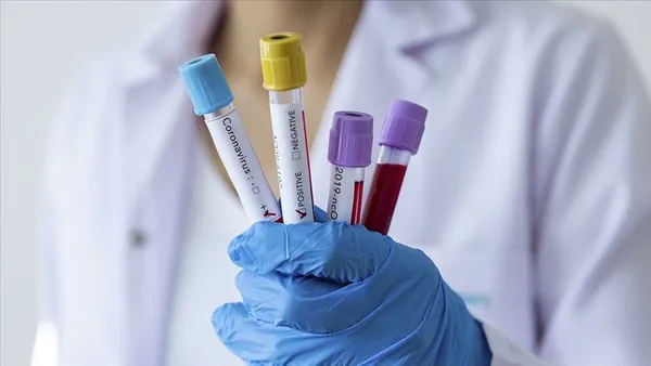 1649106036074.jpg PCR testi pozitif olanlara zorunlu karantina kalkıyor! Koronavirüste dönüm noktasına ulaşmış görünüyoruz... Almanya resmen duyurdu - 2