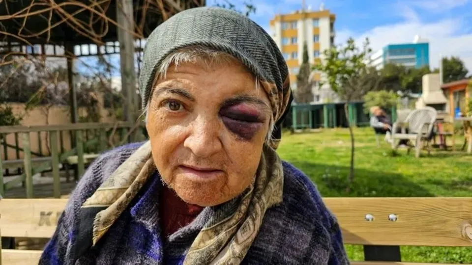 Antalya'da diyaliz merkezinde dehşet! Engelli kadın saldırıya uğradı | Gözleri morardı