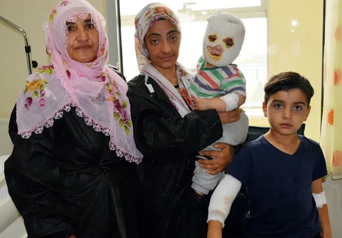 Erzurum'da kardeşlerin üzerine çaydanlık devrildi - 1