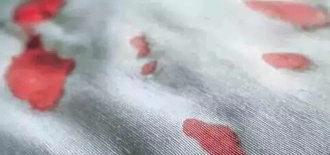 Kan lekesini anında çıkarıyor! En basit yöntem...