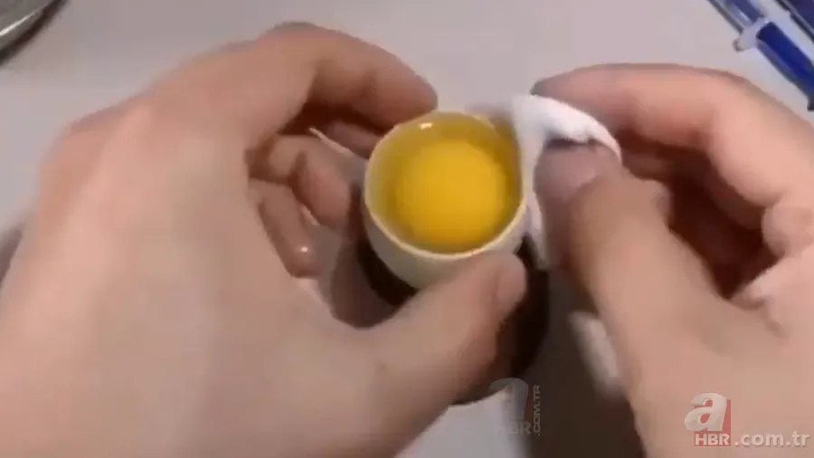 İşte civcivin yumurta içindeki gelişimi 🐣 İğne ile enjekte etti gün gün görüntüledi 🥚 25