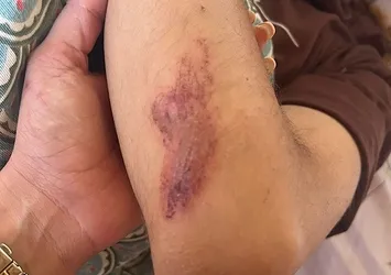 Adana'da veteriner ve ailesine "köpek" dayağı