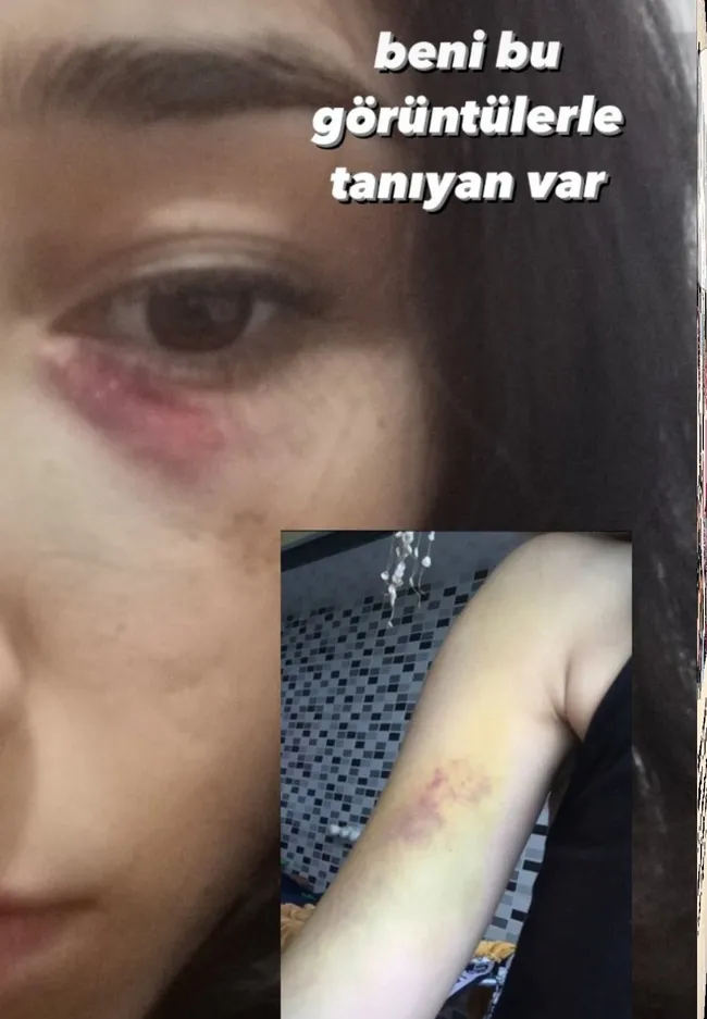 Cani sevgili bıçakla kapıya dayandı: Açmak için 30 saniyen var - 3