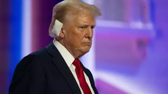 doktoru-acikladi-eski-abd-baskani-donald-trumpin-durumu-iyi-mi-1721508324429.jpeg Doktoru açıkladı: Eski ABD Başkanı Donald Trump'ın durumu iyi mi? - 2