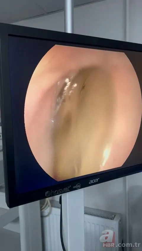 Kedinin midesindeki vantuz 4 yıl sonra fark edildi 10