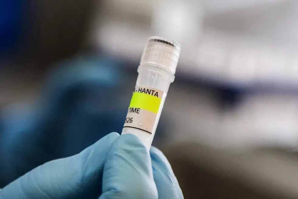 dunyada-hantavirus-alarmi-olumcul-salginin-kaynagi-arastiriliyor-1778137613382.jpg Kaynak: AFP