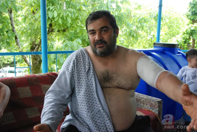 Bartın'da ayı saldırısı! 65 dikiş atıldı: Öldüğümü sanıp bıraktı 7