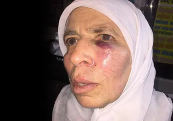 İzmir'de yaşlı kadına ‘evet’ dayağı iddiası