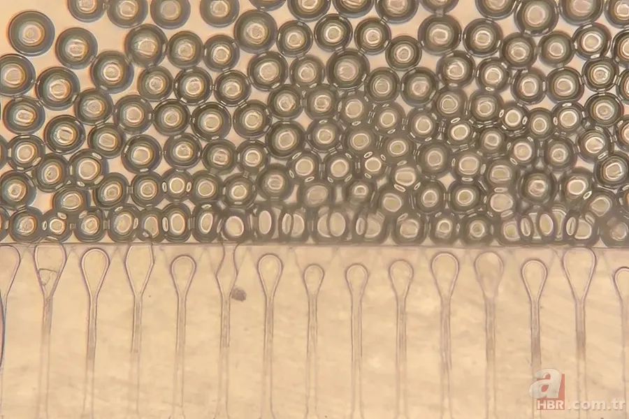 Artık neşter de dikiş de yok! Ameliyatsız organ nakli dönemi başladı 3