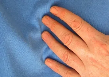 Yüksek tansiyon kalbinizi tehdit ediyor