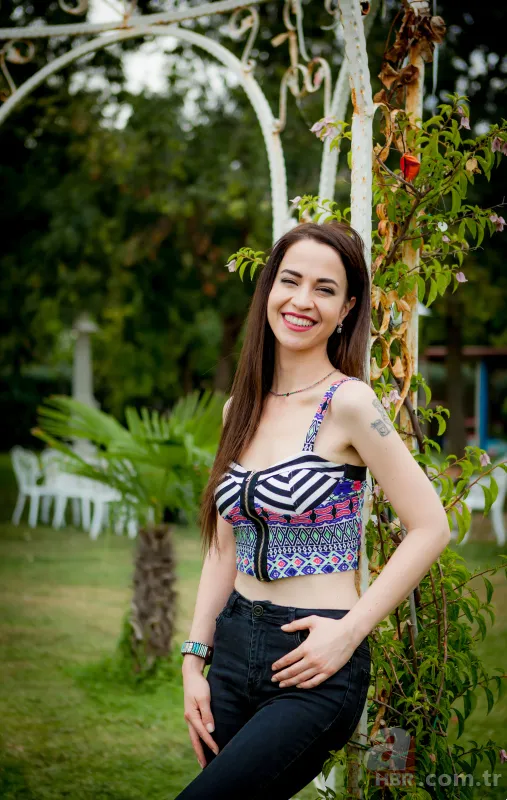 Şarkıcı ve oyuncu Zeynep Doruk dehşeti yaşadı! Köpekler saldırdı: Yüzü tanınmaz hale geldi 2