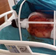 Üvey annesine kezzapla saldırdı! Nedeni ise dehşete düşürdü