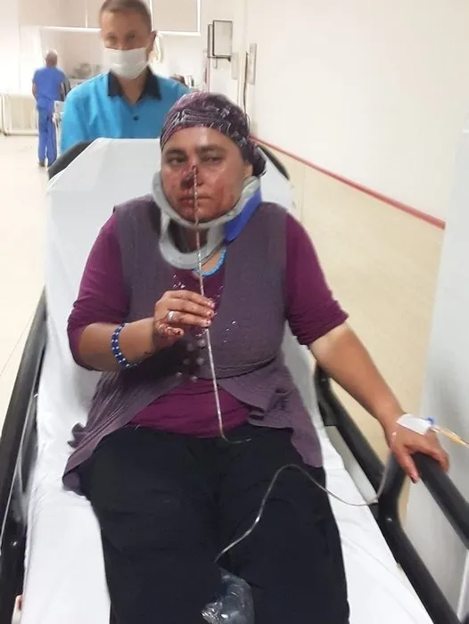 Aksaray'da kadının burnuna şiş saplandı - 3