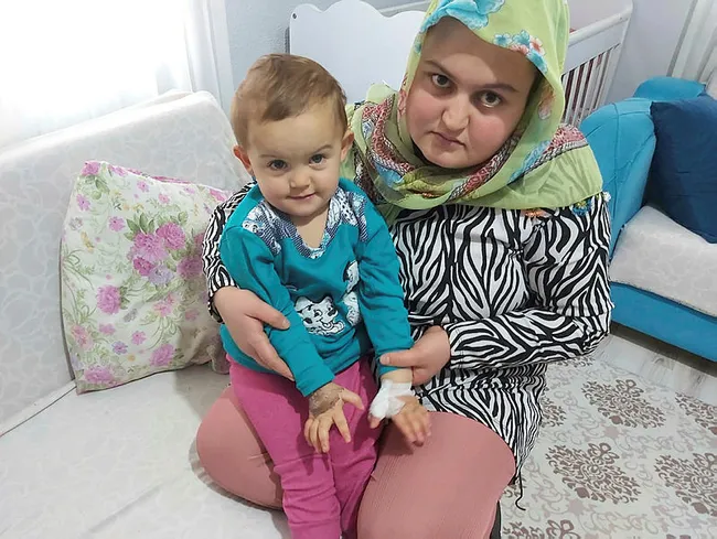 Çorum'da doktor 3 yaşındaki çocuğun yanlış parmağını ameliyat etti - 5
