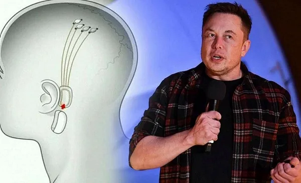 1706594171159.jpeg Elon Musk "bir ilk" diyerek duyurdu! İnsan beynine çip yerleştirildi - 2