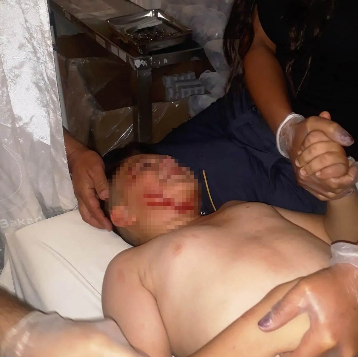 Konya’da başıboş köpek dehşet saçtı! Küçük çocuğa 40 dikiş atıldı