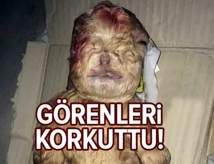 Görenler gözlerine inanamadı! Bacakları ters doğdu