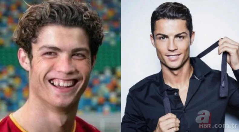 Miray Daner'e ne oldu? Yüzündeki değişim şaşırttı 12