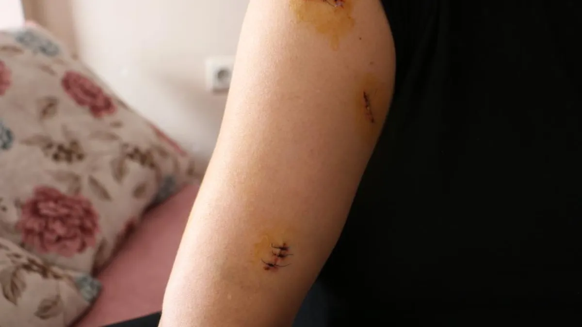 Diyarbakır'da Vahşet: Dini Nikahlı Eşini 30 Yerinden Bıçakladı