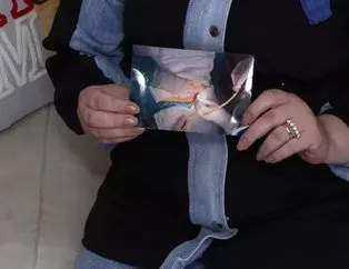 İstanbul Sultangazi'deki bir özel hastanede doğum yapan Ebru Arslan isimli kadın, doğumdan 7 ay sonra yaşadığı şiddetli ağrılar nedeniyle yeniden hastaneye gitti. Doktorlar, Arslan'ın karnında ip unutulduğunu söyledi. Ancak gerçek bir başka hastaneye gittiğinde ortaya çıktı. Arslan'ın midesinden 15 santimlik dren hortumu çıktı.