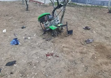 Çapa makinesine ayaklarını kaptırdı