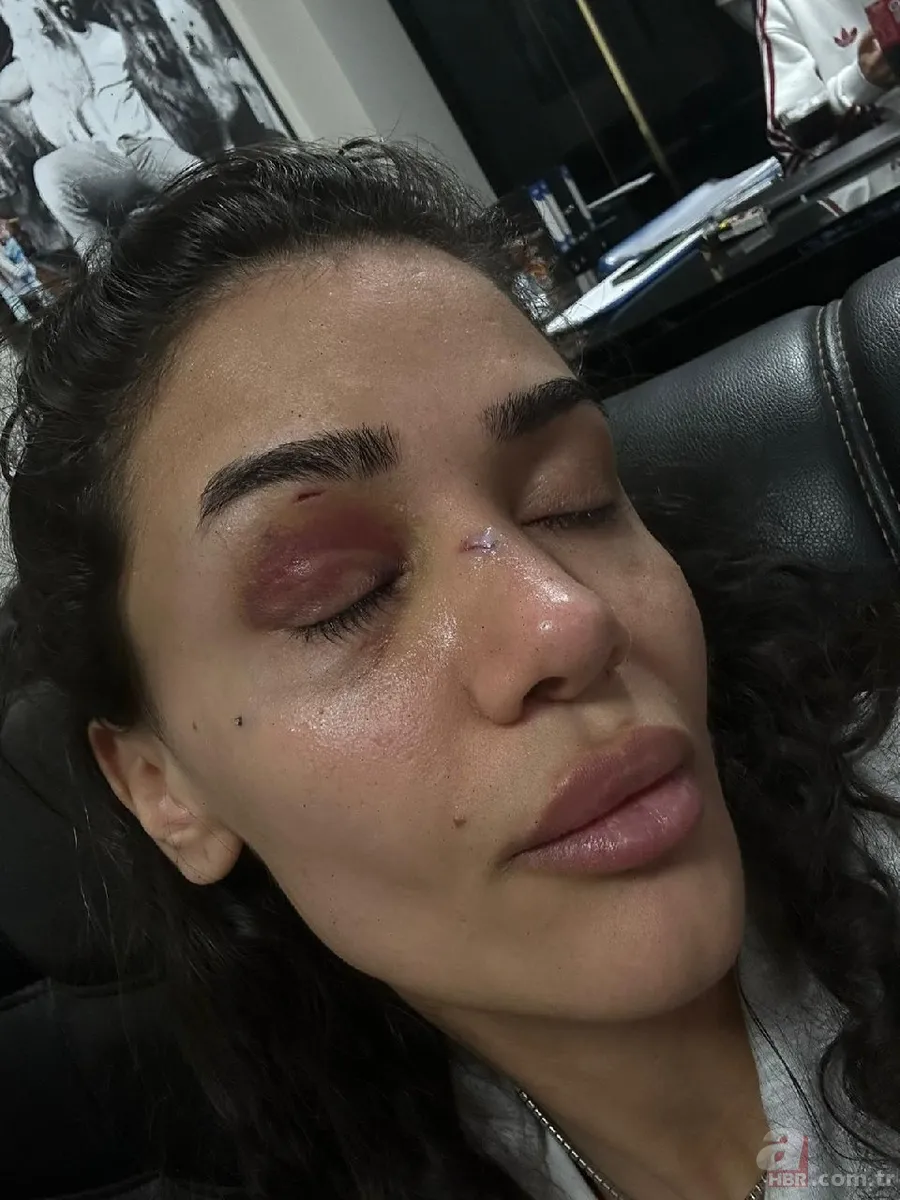 Ebru Hemşire yaşadığı dehşeti anlattı: “Ölmeden önce sesimi duyun” 9