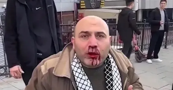1704123981684.jpeg CHP yandaşı Fatih Altaylı'nın skandalları bitmek bilmiyor! Filistin'e destek yürüyüşündeki alçak saldırıya arka çıktı - 3