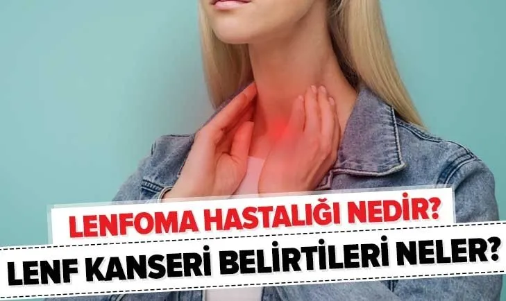 Lenfoma hastalığı nedir? Lenfoma ne demek? Lenf kanseri belirtileri nelerdir?