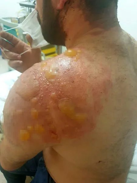 Son dakika | Kanınız donacak! İnsan insana bunu yapar mı? 'Kardeşimizden boşan' diye 40 dakika dövüp kaynar su döktüler