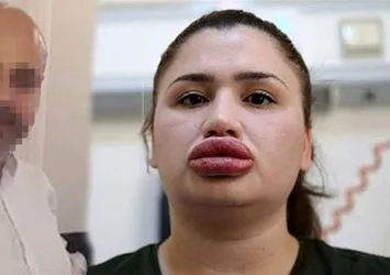 Estetikçi kuaföre bir darbe daha