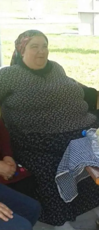 2 yılda 95 kilo verdi: Çorabımı bile giyemiyordum