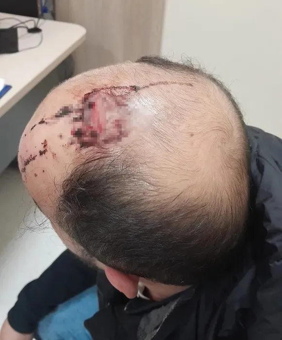 1771920635213.jpeg 24 milyonluk borç aileyi parçaladı! - 1