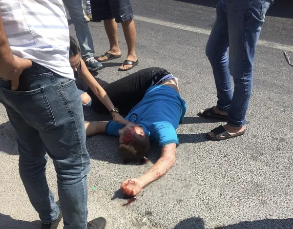 mersinde-feci-kaza-araba-carpan-ogrenci-havaya-uctu-1631540608635.jpg Mersin’de feci kaza! Araba çarpan öğrenci havaya uçtu - 2