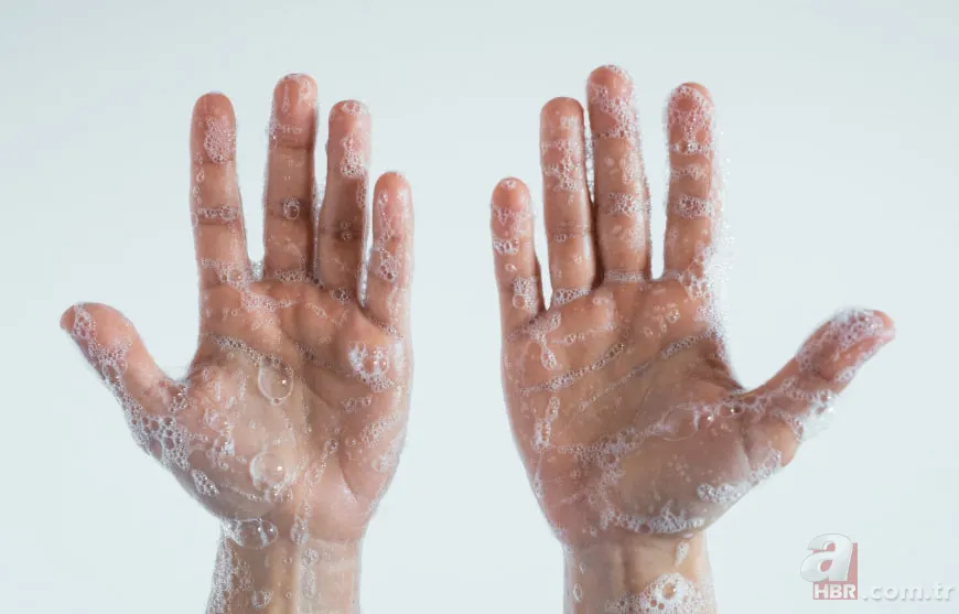 Soğuk hava cildi kurutuyor: İşte çatlayan elleri onaran 4 etkili bakım yöntemi 2