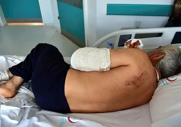 Muğla'da pitbull dehşeti! Kolunu parçaladılar