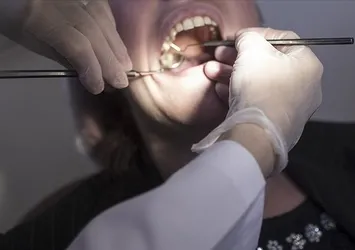 Diş tedavisinde yapay zeka çağı